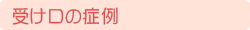 受け口の症例